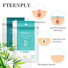 FTEENPLY-Parche Invisible para acné, pegatinas para acné, tratamiento de imperfecciones, removedor de granos maestro, herramienta de belleza para el cuidado de la piel 2024 - compra barato