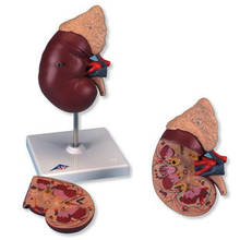 Modelo de riñón y glándula adrenal, 2 partes del riñón humano, modelo anatómico, estructura de Órgano Interno 2024 - compra barato