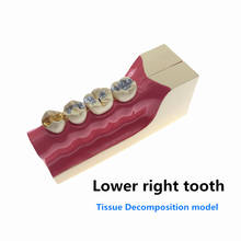 Modelo de estudo anatomia dos dentes, modelo de estudo de seção transversal dos molares 2024 - compre barato