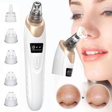Blackhead Remover Electric Vacuum Suction Pore Cleaner Face Deep Nose Cleaner T Zone Pore Acne Pimple Removal Clean Skin Tool 2024 - buy cheap