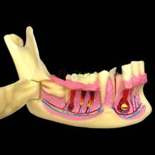 Modelo anatômico de demonstração de dentes, modelo de ensino odontológico mandibular 2024 - compre barato