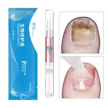 Nail Fungus Repair Treatment Pen Products Onychomycosis Paronychia Anti Fungal Nail Infection Chinese Herbal Care Oil Pen 2024 - buy cheap