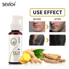 Sevich-espray para el crecimiento del cabello, esencia de jengibre, anticaída del cabello, nutre las raíces, cuidado rápido del cabello, suero para el tratamiento del cabello, 50ml 2024 - compra barato