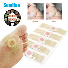 Sumifun 12pc Foot Corn Removal Killer Calluses Plantar Warts Thorn Pain Relief Curative Plaster Medical Sticker Curative Plaster 2024 - купить недорого