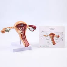 Modelo de úsculo reprodutor feminino, modelo de ensino de ajudante pomárico ginecológico para ensino 2024 - compre barato