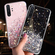 Luxo Brilho Caso Estrela Para Samsung Galaxy A51 A71 A70 A50 A10 A20 A30 A60 A80 A10S S20 Nota 10 9 8 S10 S9 S8 Plus S10E Capa 2024 - compre barato