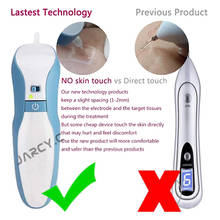 MAGLEV Tattoo Mole Removal Plasma Pen Fibroblast Laser Facial Freckle Dark Spot Remover Wart Removal Beauty Machine Face Care 2024 - buy cheap