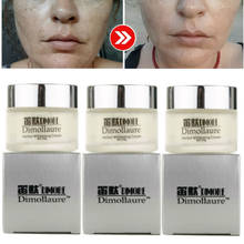 Dimollaure Herbal Whitening Freckle Cream Face Removal Melasma Pigment Melanin Pregnant Acne Scar Dark Spots Retinol Face Cream 2024 - buy cheap