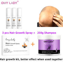 180ml omylady anti queda de cabelo crescimento spray + 250g cabelo crescimento shampoo óleo essencial líquido para homens mulheres crescimento do cabelo conjunto 2024 - compre barato