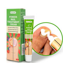 1pcs Nail Fungus Treatment Cream Removal Nail Paronychia Onychomycosis Ointment Feet Whitening Toe Care Plaster 2024 - buy cheap
