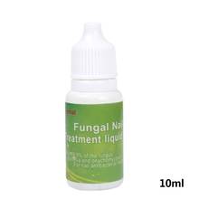 Chinese Medicine Herbs Toe Nail Fungus Treatment Anti Fungal Nail Infection Nail New 2021 2024 - buy cheap