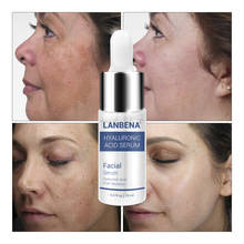 LANBENA Hyaluronic Acid Serum Blackhead Removing Moisturizing Acne Treatment Skin Care Repair Whitening Anti-Aging Winkles 15ml 2024 - buy cheap