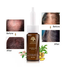 15ml Anti-hair Loss Ginger Oil Hair Growth Product Natural extraction material For Man and Woman Free Shipping 2024 - buy cheap
