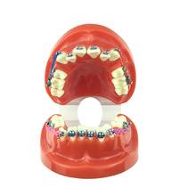 Dental Orthodontic teeth model with brackets and ligature wire affixed Dental Supplies 2024 - buy cheap