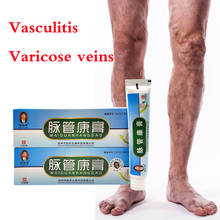 1 Pc Varicose Veins ointment vasculitis treatment Phlebitis Angiitis inflammation blood vessel Rotten legs Varicose Veins Cream 2024 - buy cheap