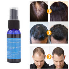 Lanthome Hair Growth Oil Products Hair Loss Treatment Regrowth Essence Men and Women Hair Care Growth Serum Beauty Essence 2024 - buy cheap