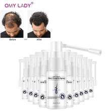 OMY LADY-Spray anticaída de cabello para hombre y mujer, aceite esencial líquido para el crecimiento del cabello, reparación de la regeneración del cabello seco, 10 Uds. 2024 - compra barato