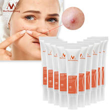 10PCS Skin Care Acne Cleaning Cream Remove Repair Comedone Pimple Acne Quickly Face Acne Cream Remover Anti Acne Treatment 2024 - buy cheap