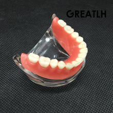 Modelo de dentadura inferior Mandibular Interior, para restauración de implante Dental, estudio pedagógico 2024 - compra barato