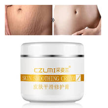 Creme precioso para o corpo, removedor de estrias e remoção de cicatrizes, obesidade pós-parto, gravidez, creme facial, cuidados com a pele 2024 - compre barato