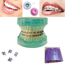 Equipo de blanqueamiento Dental, restauración de implantes dentales, modelo de medicina, odontología, productos Nit 2024 - compra barato