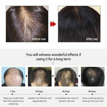 50 мл спрей для роста волос эссенция имбиря эффективный экстракт питает волосы для женщин и мужчин против выпадения корней Y7U1 2024 - купить недорого