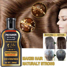 Hair Shampoo  Hair Darkening Permanent Black Color Anti Gray Hair Treatment White Removal Natural Black Hair Health Shampoo 2024 - buy cheap