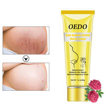 1.4 Oz/40G OEDO Rose Remove Stretch Marks Cream Anti Wrinkle Anti Aging Maternity Skin Repair Remove Pregnancy Scars Body  TSLM1 2024 - buy cheap