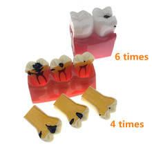 Modelo de dentes para comparação de modelos de escola, modelos de estudo 4 vezes/6 vezes para dentistas, estudo e pesquisa 2024 - compre barato