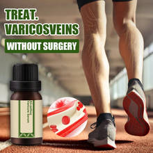 All-Natural Vari-Cure Serum All-eelhoe Varicose Vein Treatment for Treatment Legs Care Health99 2024 - buy cheap