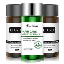 Putimi Powerful Hair Growth Serum Essence Anti Hair Loss Products Longer Thicker Hair Care Prevent Baldness Grow Hair Essence 2024 - buy cheap