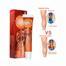 Varicose Veins Cream Portable Varicose Vein Treatment Cream Varicose Cream Spider Vein Treatment for Legs Care 20g 2024 - buy cheap