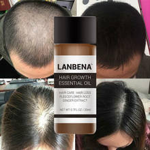 LANBENA эфирное масло для роста волос быстрое мощное против выпадения волос Жидкое лечение для мужчин t Предотвращение выпадения волос для мужчин и женщин Уход за волосами 2024 - купить недорого