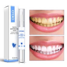 EFERO Teeth Whitening Oral Hygiene Removes Plaque Stains Bleaching Liquid Toothpaste Teeth Care Products TSLM2 2024 - buy cheap