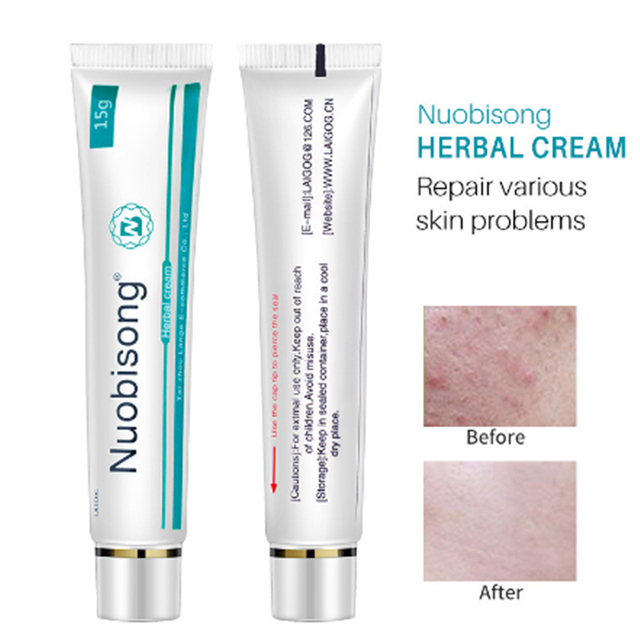 1pc Nuobisong Face Skin Care Treatment Face Pimples Scar Stretch Marks Removal Acne Treatment Whitening Moisturizing Cream Tslm1 Buy Inexpensively In The Online Store With Delivery Price Comparison Specifications Photos