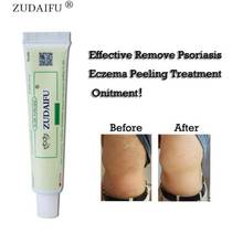 ZUDAIFU-Crema corporal para la Psoriasis, pomada para el cuidado de la piel, Dermatitis, Eczema, ungüento para el tratamiento de la piel, sin caja, 3 uds. 2024 - compra barato