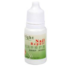 1Pc 10ML Fungal Nail Treatment Oil Onychomycosis Paronychia Anti Fungal Infection Chinese Herbal Toenail Care Medicinal Liquid 2024 - buy cheap