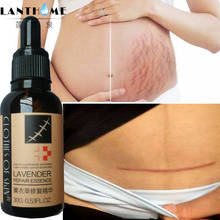 Lavender Extract Stretch Marks Removal Repair Surgical Scar/burn Marks Essential Oils Pure Natural Maternity Skin Repair Cream 2024 - buy cheap
