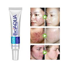 Bioaqua anti acne rosto creme facial soro máscara tratamento acne controle de óleo encolher poros hidratante clareamento cuidados com a pele 2024 - compre barato