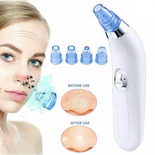 4 Heads T-zone Electric Acne Remover Adjustable Blackhead Black Dot Pore Vacuum Cleaner Pimple Suction Tools Face Skin Care Tool 2024 - buy cheap