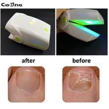 NEW Home Use Cure Toe Nail Fungus Blue Light and Laser Light Therapy Device Onychomycosis Anti Fungal LLLT Physiotherapy 2024 - buy cheap