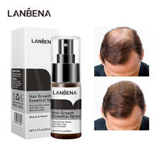 LANBENA-Spray de esencia para el crecimiento rápido del cabello, suero Germinal que previene la calvicie, Anti pérdida de cabello, nutre las raíces, cuidado del cabello para hombres y mujeres 2024 - compra barato