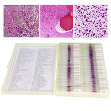 100pcs seções patológicas médicas do corpo humano ele manchando o espécime de tecido preparado típico corrediças microscópio fatia de vidro 2024 - compre barato