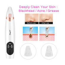 Electric Blackhead Remover Face Nose Pore Vacuum Suction Black head Acne Comedo Extractor Rechargeable Beauty Skin Care Tools 45 2024 - buy cheap