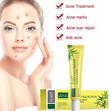 Effective Acne Cream Acne Treatment Cream Acne Removal Fade Acne Spots Oil Control Shrink Pores Whitening Moisturizing Skin Care 2024 - buy cheap