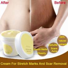 Obesity Pregnancy Cream Precious Skin Body Cream Stretch Marks Remover Scar Removal Powerful Postpartum Skin Care 2024 - buy cheap