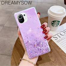 Glitter Bling Soft Clear Case For Xiaomi Mi10T Lite POCO X3 M3 Redmi 9 9A 9C Note 9S 9 Pro Redmi Note 9T Glitter TPU Coque Cover 2024 - buy cheap