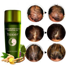 Yoxier herbal crescimento do cabelo óleo essencial shampoo cabelo estilo óleo grosso rápido reparação crescente tratamento produtos de crescimento do cabelo líquido 2024 - compre barato