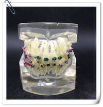 Модель зубных ортодонтических зубов с buccal трубками/Ортодонтическая модель зубов M3005/Ортодонтическая модель практики с кронштейном 2024 - купить недорого