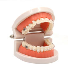 Dental Modelo Ortodôntico Suporte Cerâmico Completo Com Anti-prego Para O Dentista Doença Médica Ensino Estudo Oral Care 2024 - compre barato